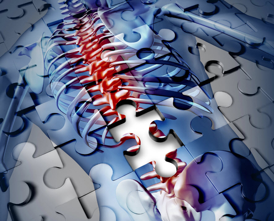 Neck, Back and Spine Personal Injuries