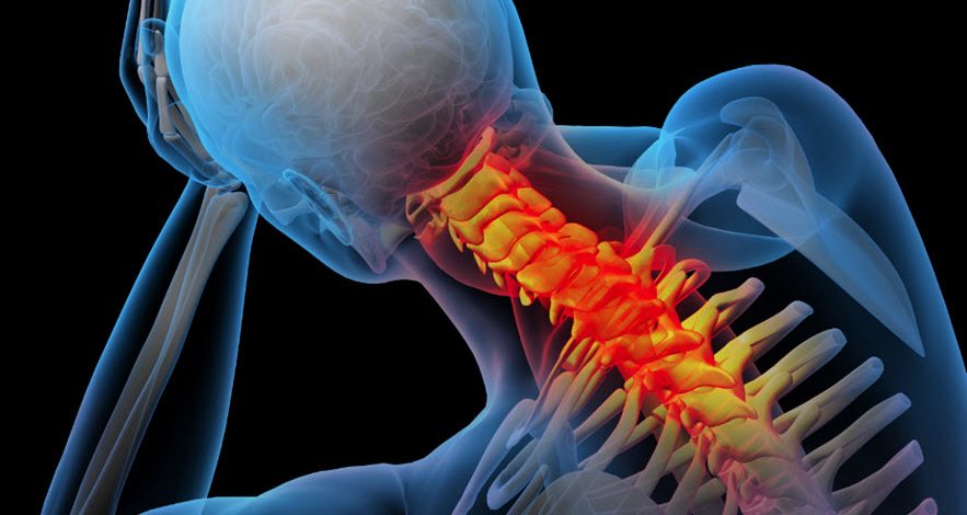 Neck Pain from a Work Accident