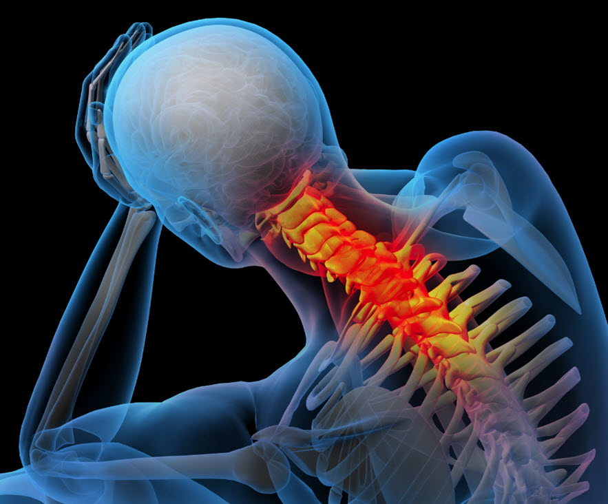 Neck Pain from a Work Accident